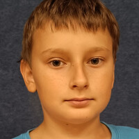 MR